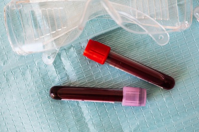 Применение фармакогенетического тестирования на статины в Республиканском медико-генетическом центре Республики Башкортостан